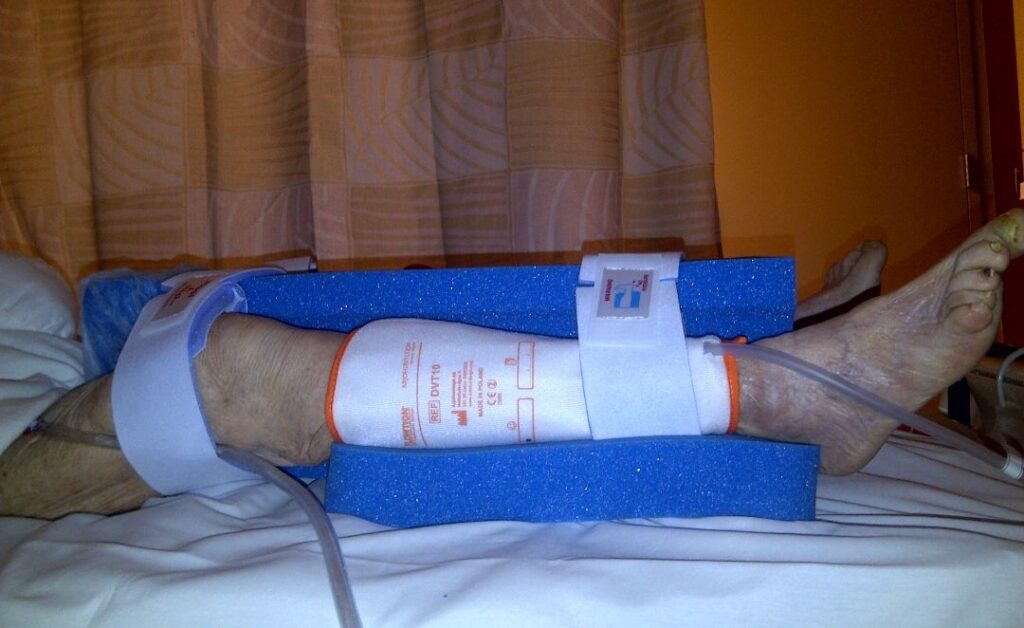 Patient's legs from right side in supine position